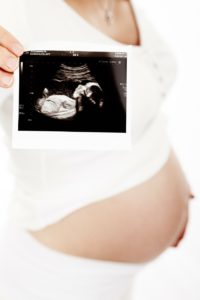 schwangerschaft mitteilen schwangerschaft verkünden schwangerschaft bekannt geben ultraschallbild